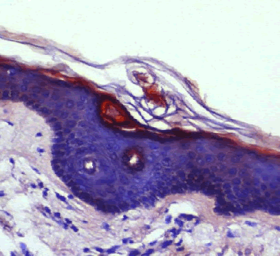 Pathology
