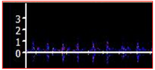 Insonation