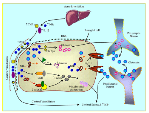 Pathophysiology