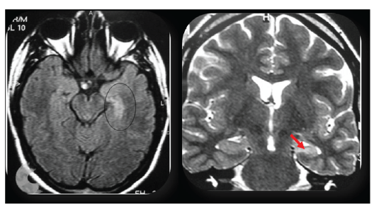 Sagittal