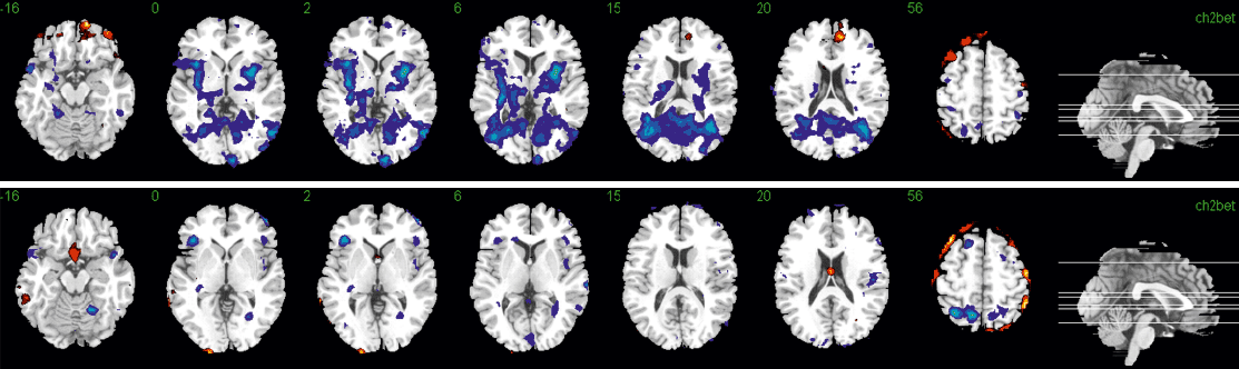 Brain