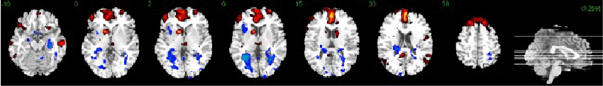 Brain