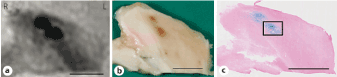 Histopathology