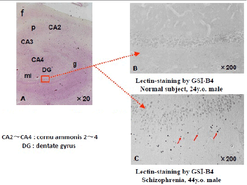 hippocampal formation