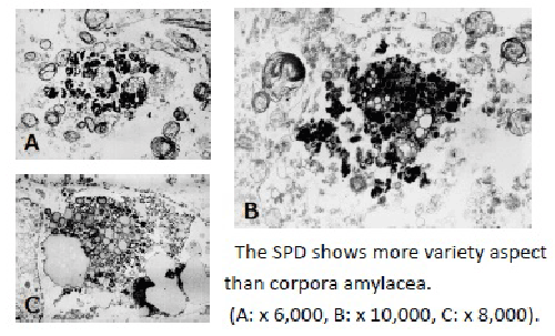 Ultrastructure of SPD 