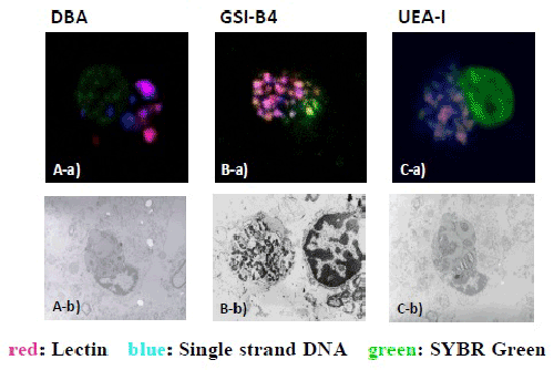 Lectin-positive SPD 