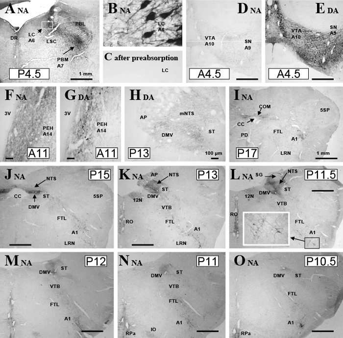 immunohistochemistry
