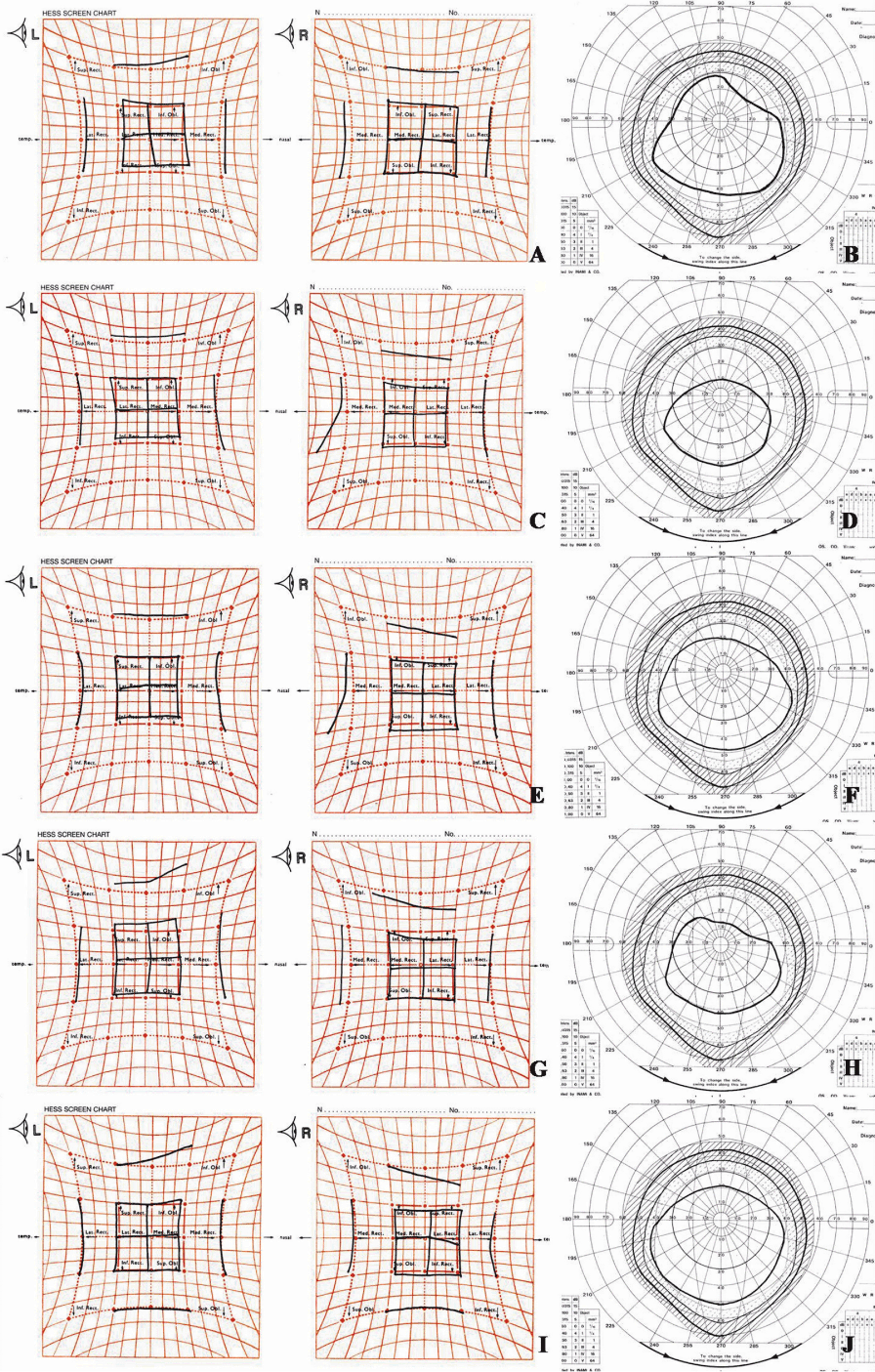 figure 1 hess charting