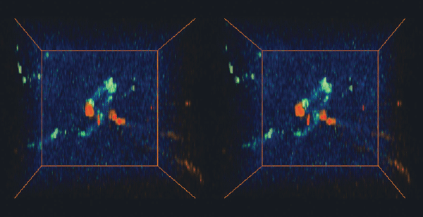 stereoscopic
