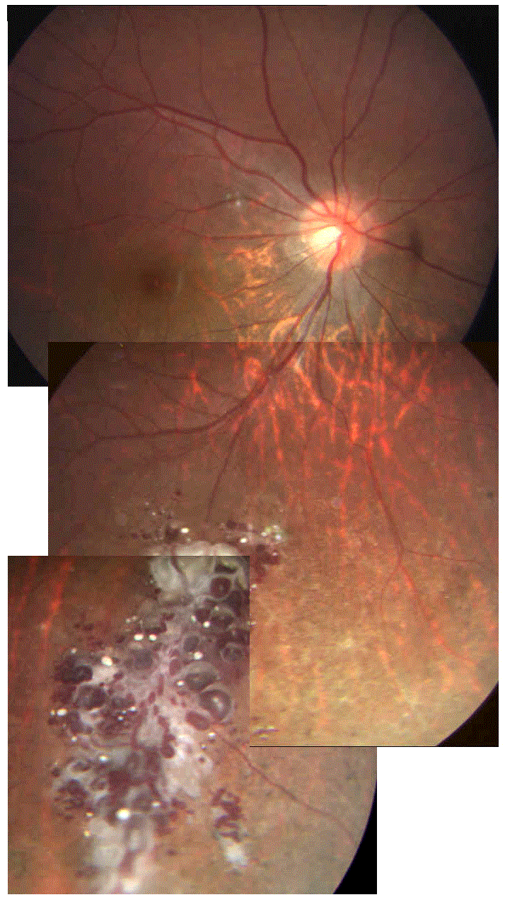 Fundus