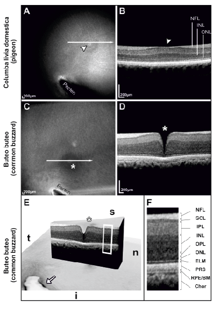 fundus