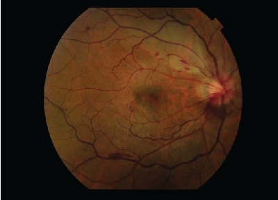 Fundus