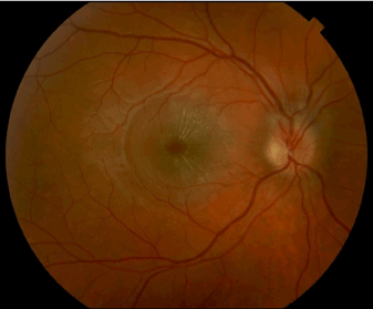 Fundus
