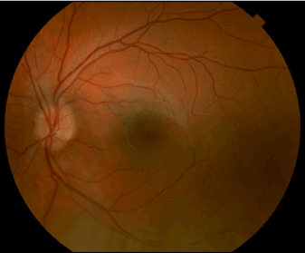 Fundus