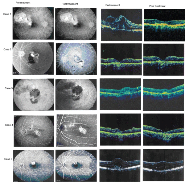 angiography