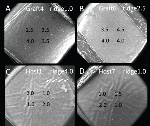 magnification