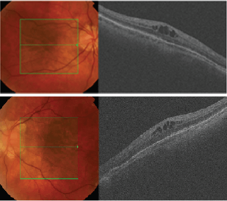 fundus