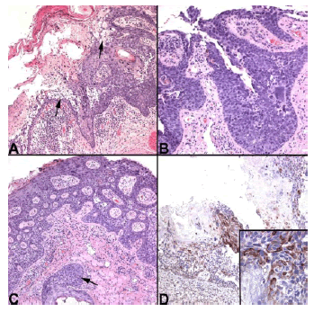 Photomicrograph
