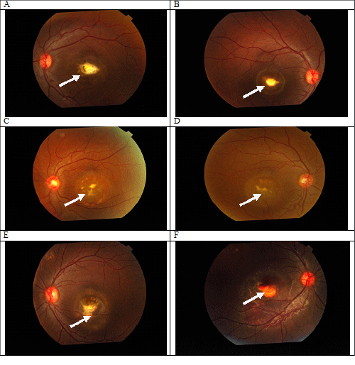 Fundus