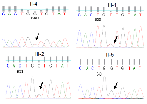 chromatogram