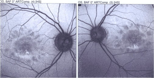 Fundus