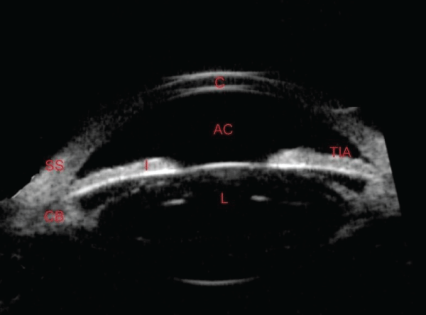 anterior