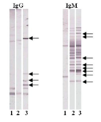 immunoblot