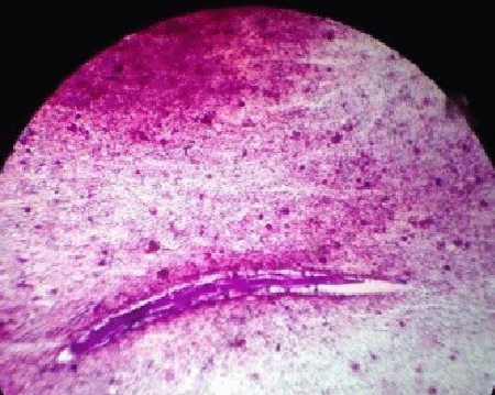 larva