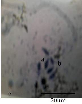 Photomicrograph