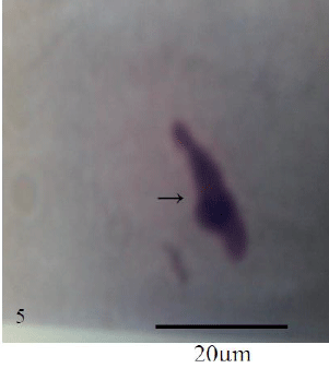 Photomicrograph