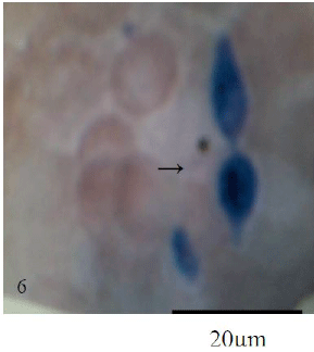 Photomicrograph