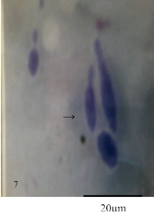 Photomicrograph