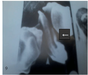 micrograph