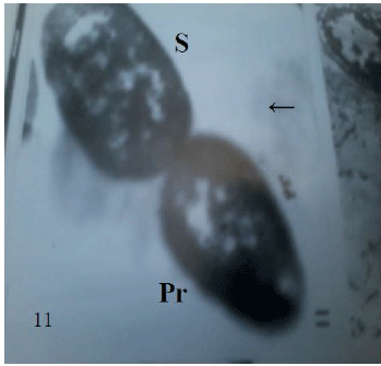 micrograph