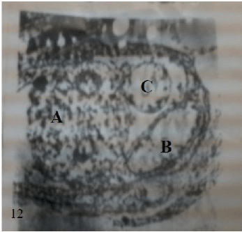 micrograph
