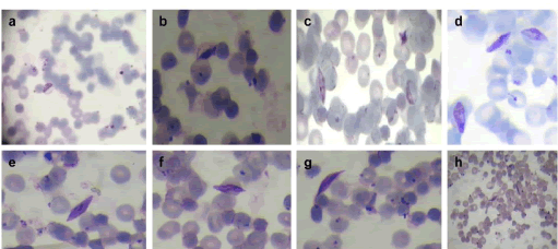 gametocytes