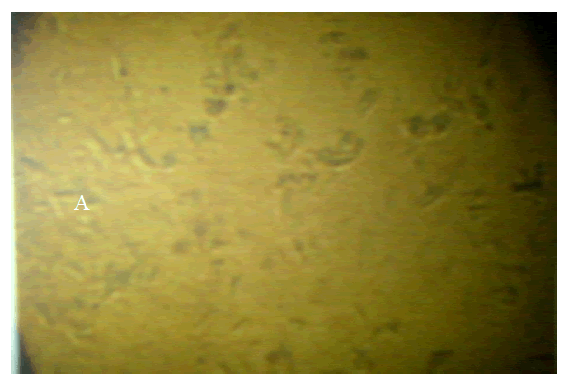 Photomicroscopy