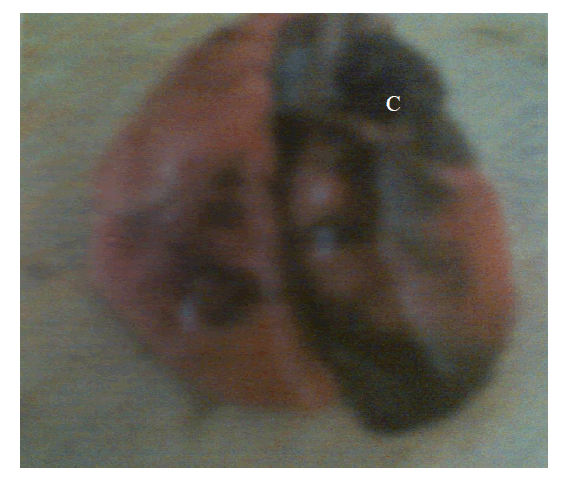 Enlarged