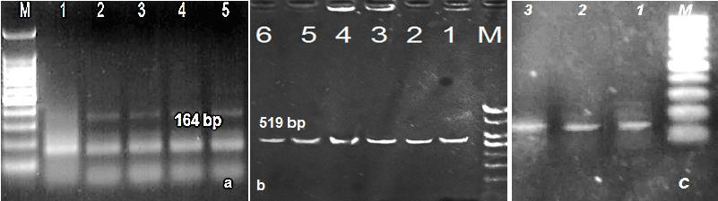 electrophoresis