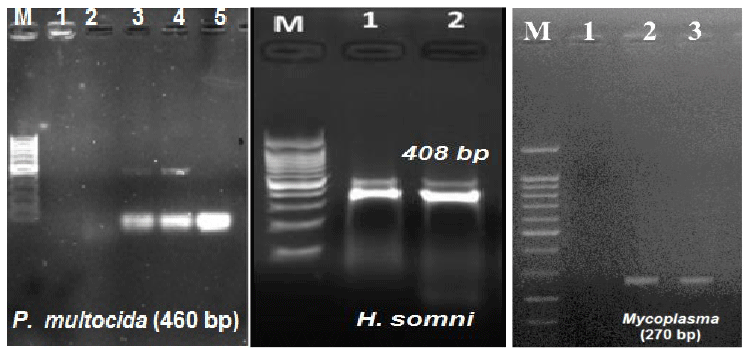 electrophoresis