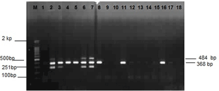 electrophoresis