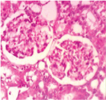 glomerular