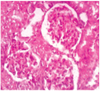 histopathologicl
