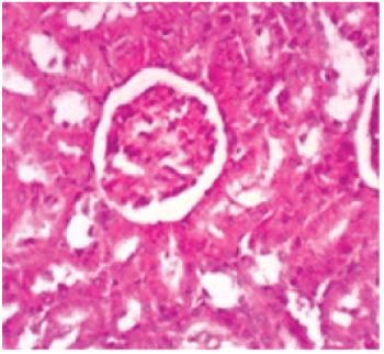 histopathologicl
