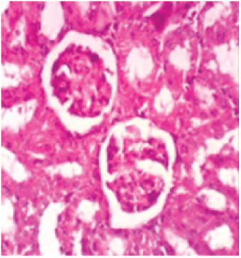 histopathologicl