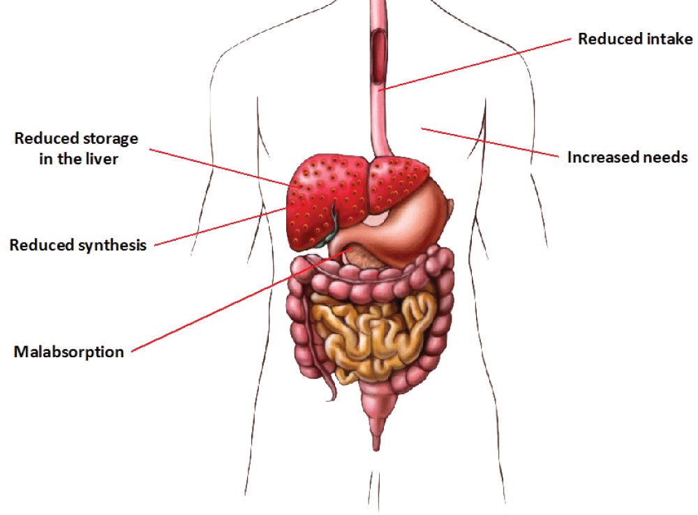 Cachexia