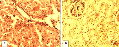 Hepatic