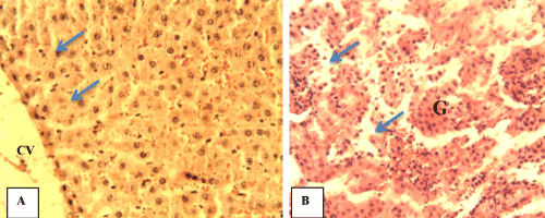 interstitium