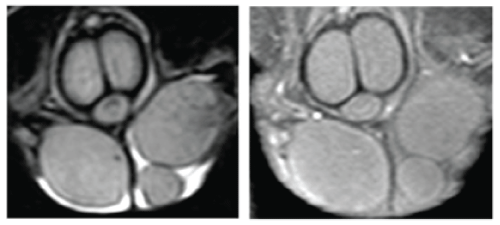 Coronal