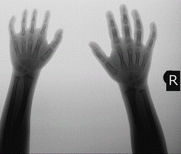 finger
